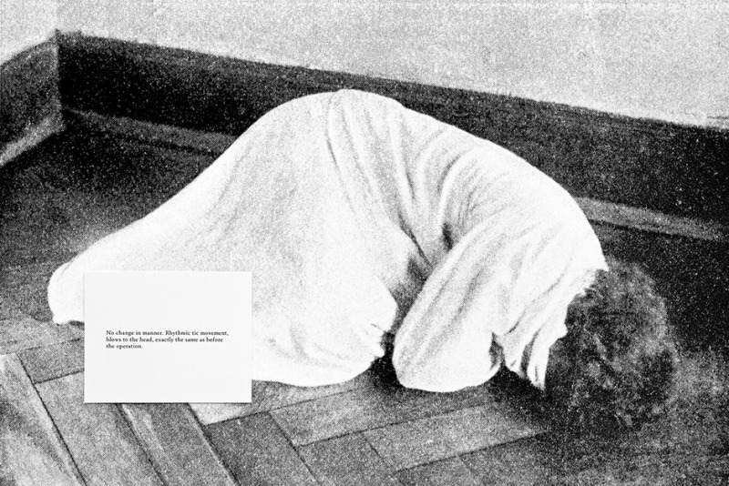 Atlas und Grundriss der Psychiatrie (Blows to the head), 2013