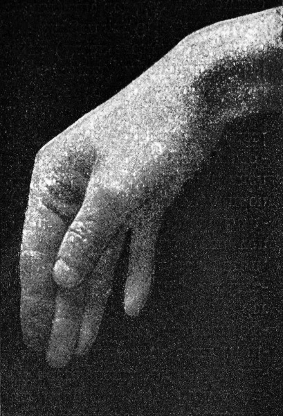 Atlas und Grundriss der Psychiatrie (Hand #3), 2013