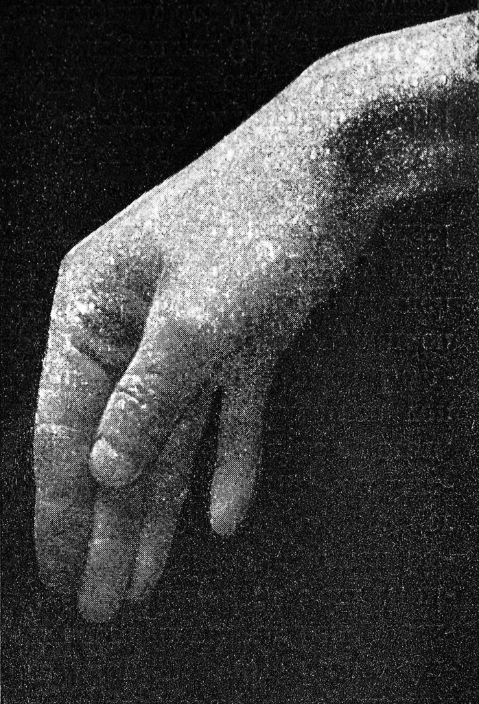 Atlas und Grundriss der Psychiatrie (Hand #3), 2013